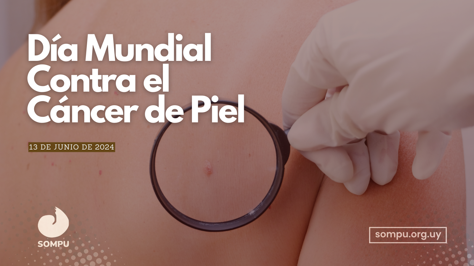 13 de junio: Día Mundial Contra el Cáncer de Piel