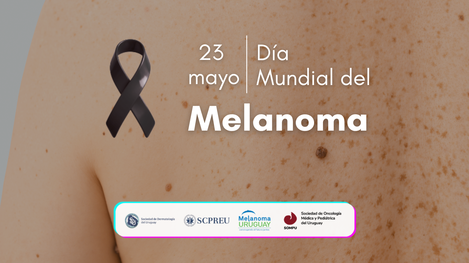 23 de mayo - Día Mundial del Melanoma