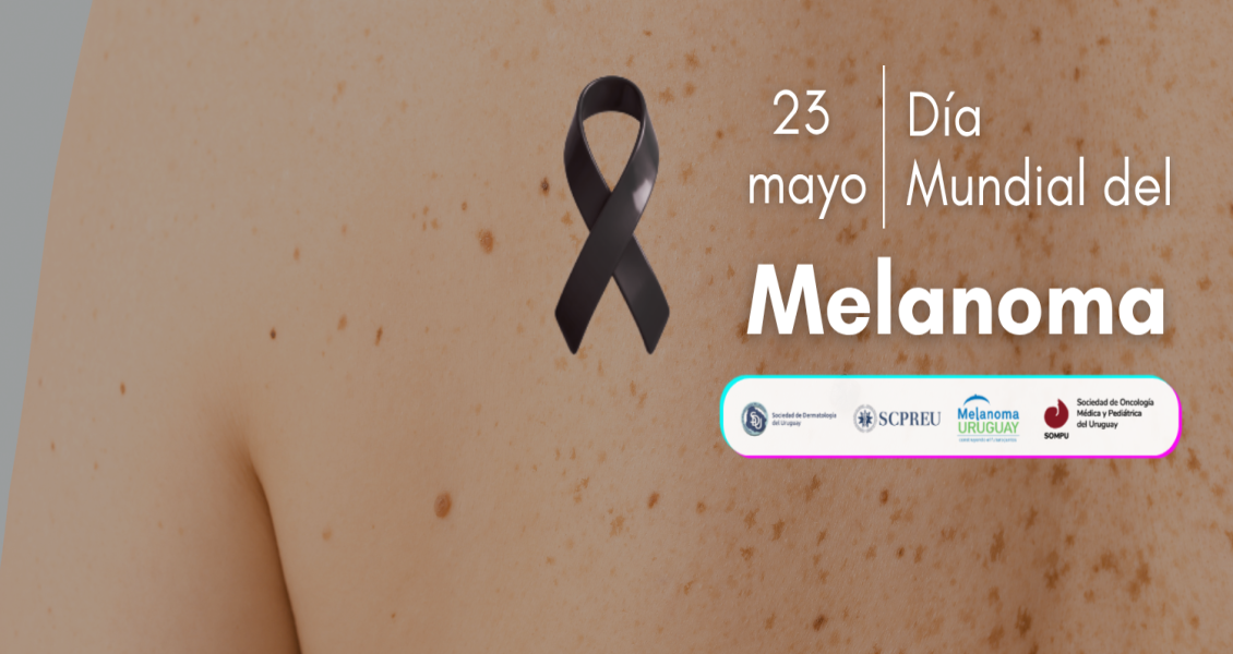 23 de mayo - Día Mundial del Melanoma